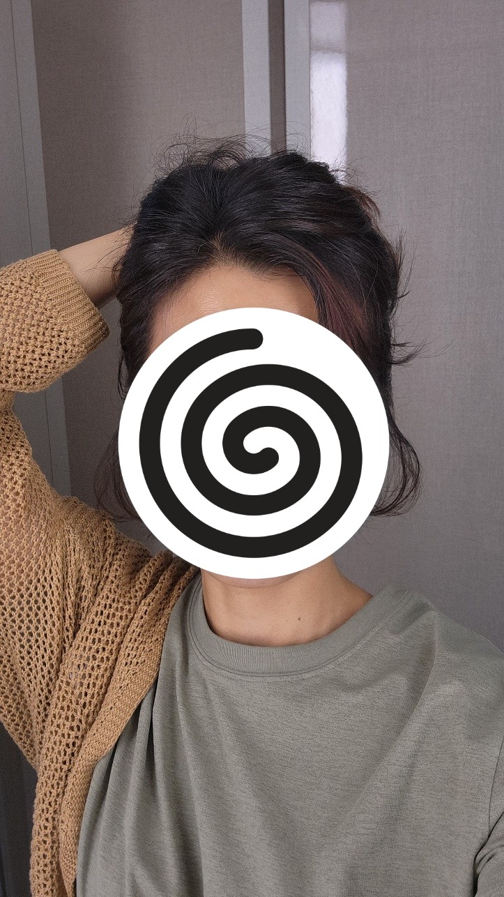 항암 탈모 머리빠지기 전에 찍어놓은 소중한 사진