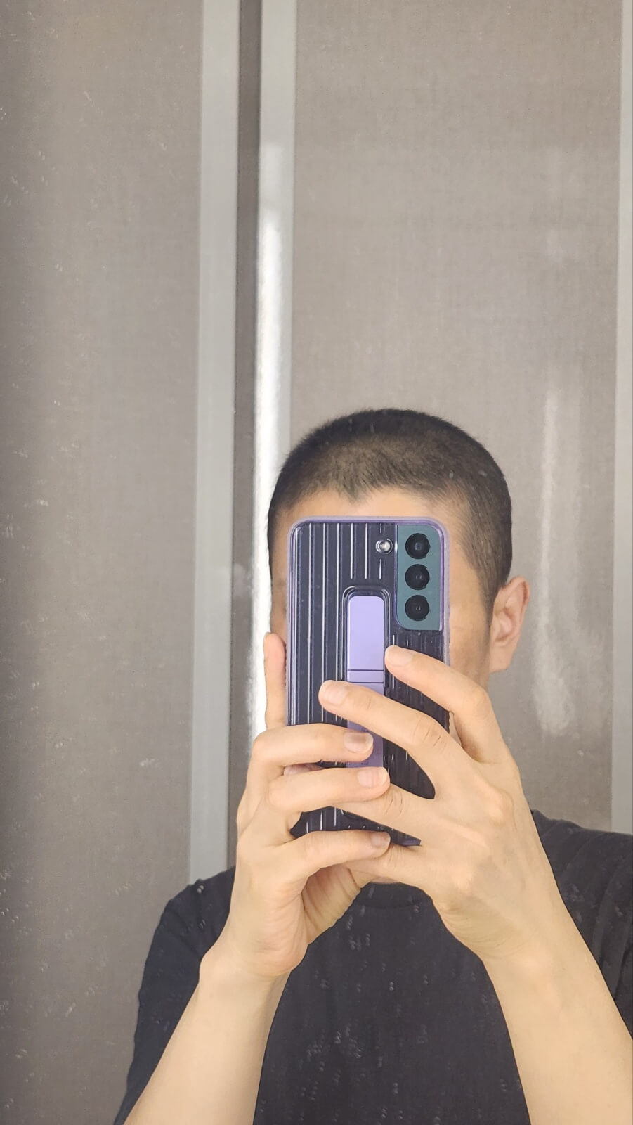 항암 후 머리카락이 점점 자라나는 모습