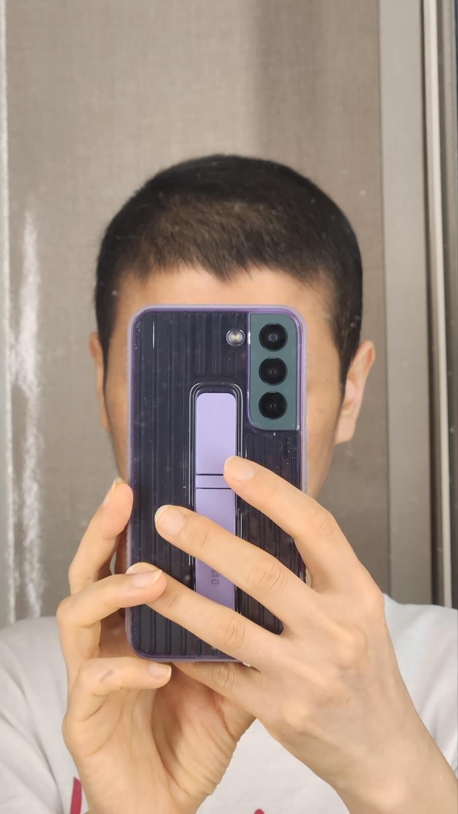 항암 후 머리카락이 점점 자라나는 모습