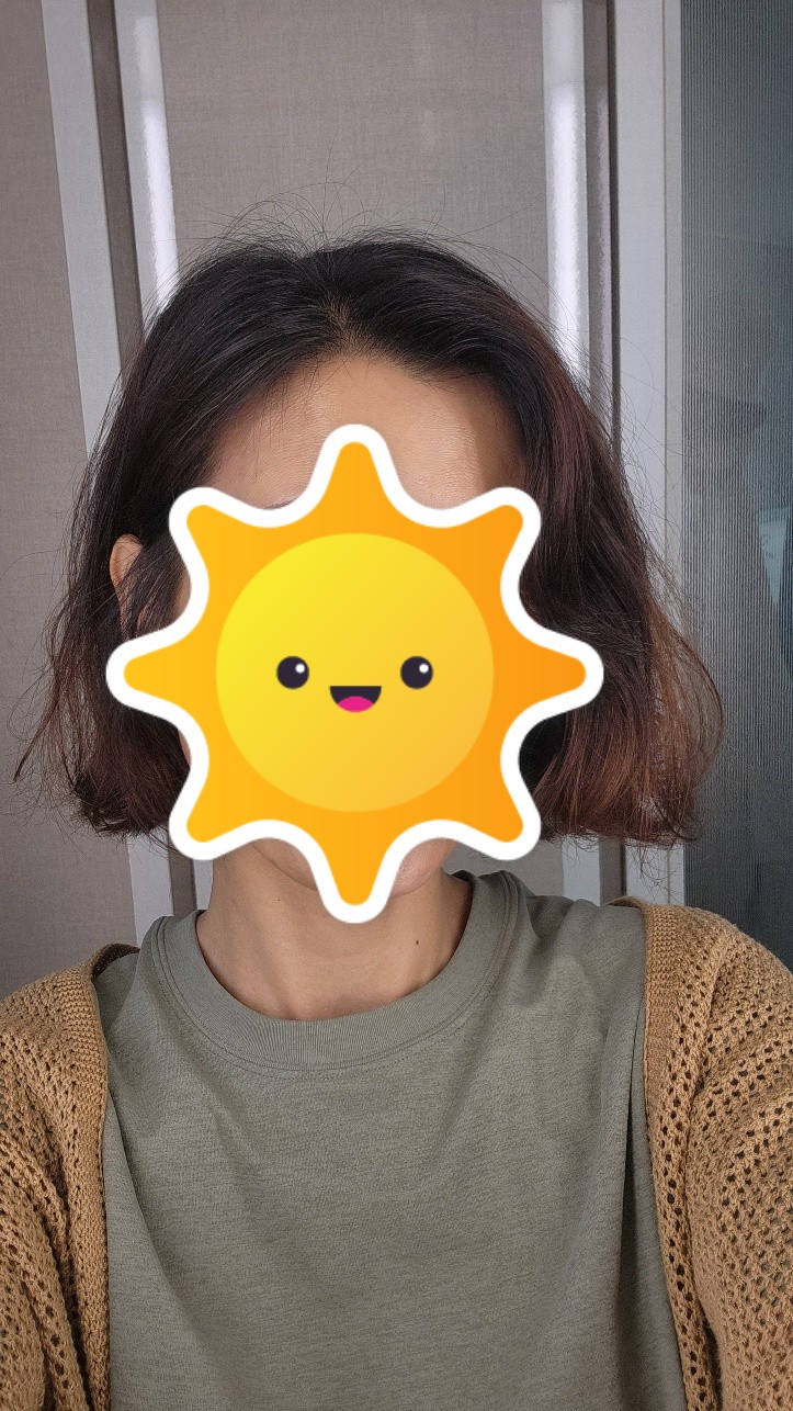 항암 탈모 머리빠지기 전에 찍어놓은 소중한 사진