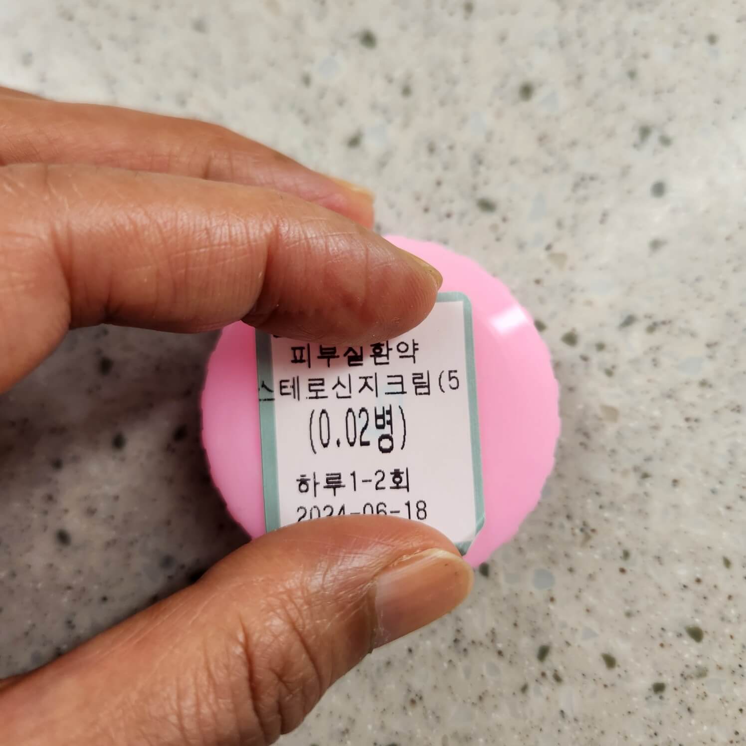 두피 관리 위해 피부과 처방