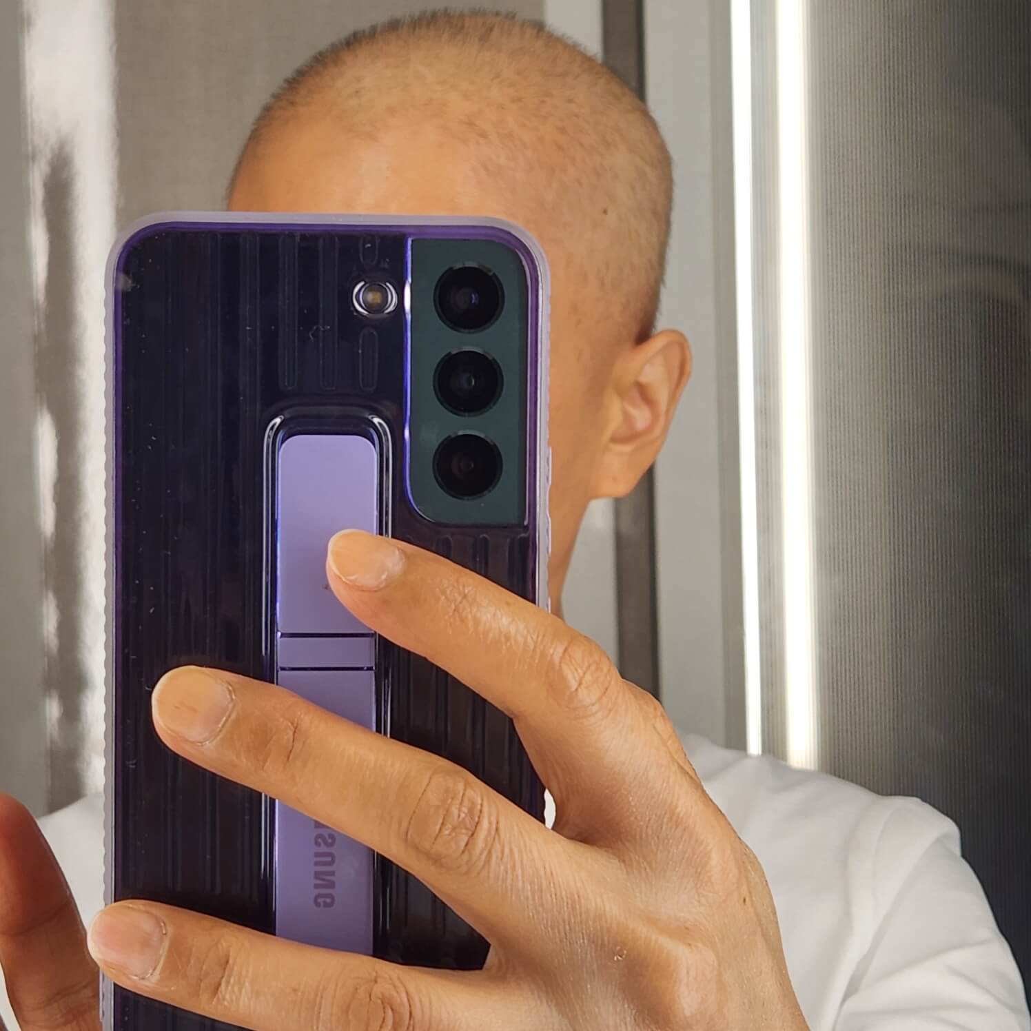 머리 빠진 민머리 모습