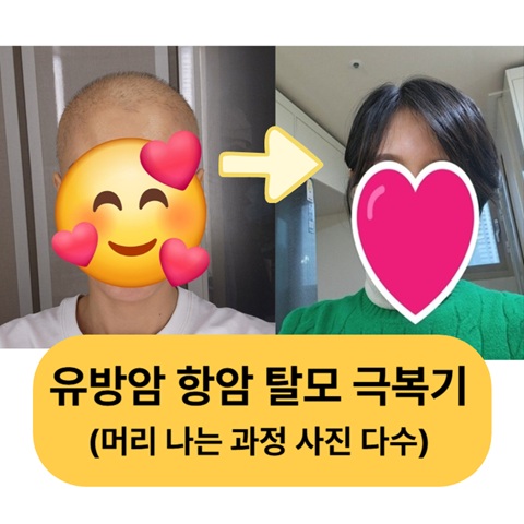 유방암 항암 탈모 극복기, 머리 나는 과정 사진 다수 포함
