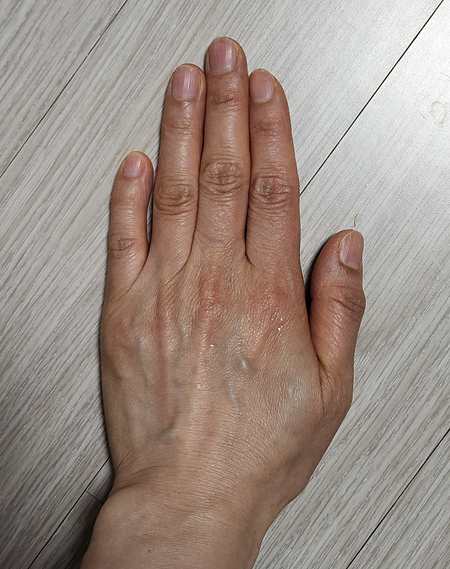 나의 손가락 사진, 약간 휘었다